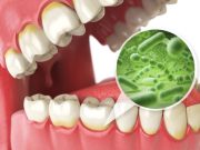 How To Avoid Yellow Teeth And Mouth Odour By Staying Away From These Bad Habits