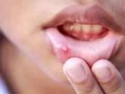 If Any Of These Three Symptoms Appear On Your Body, Cancer Is Trying To Attack You
