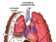 Your Lungs Are Not In Good Condition if You Experience the Following