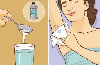 Are You Battling With Armpit Odour? Here’s How To Treat It