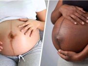What Does The Dark Straight Line On A Pregnant Woman’s Stomach Mean?