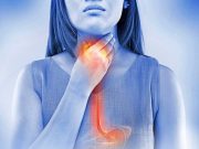 Best heartburn treatments RANKED by a pharmacist: From Pepto-Bismol to Gaviscon, what to take when you’re struggling with painful acid reflux