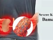 If Your Kidneys Are In Danger, Your Body Will Give You These 8 Signs