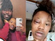 I Still Love Him, Lady Tells Doctor After Boyfriend Destroyed Her Face With Assault