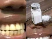 How To Remove Deep Brown Stains From Your Teeth With These Kitchen Ingredients