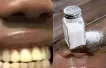 How To Remove Deep Brown Stains From Your Teeth With These Kitchen Ingredients
