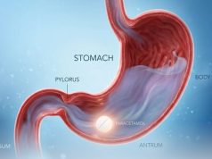 In This Position, Paracetamol Works Up To Five Times Faster, Researchers Say
