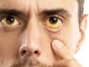 Early Warning Signs of Cancer You Should Never Ignore
