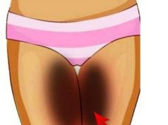 Ladies, If Your Inner Thighs Are Dark, See 5 Safe Ways You Can Improve Skin Tone
