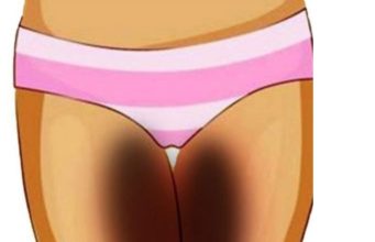 Ladies, If Your Inner Thighs Are Dark, See 5 Safe Ways You Can Improve Skin Tone
