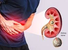 Part of Body Where You Will Feel Pain If The Kidney Is Having Issues
