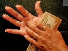Itchy Palms Does Not Call For Money; Here Is What It Means About Your Health