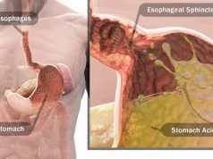 Why Do You Get Acidity, Heartburn, and Stomach Gas?