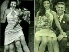 Sèe A Woman Who Had Four Legs And Two Private Parts