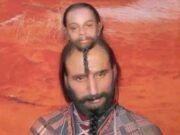 The Mexican Man That Had Two Heads. See His Photos Before Losing One Of His Heads