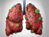 Detoxify the lungs: 8 strategies to do absolutely to cure respiratory problems