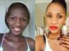 List Of Creams That Can Lighten Your Skin Fast With No Side Effects