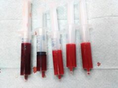 What To Know About HIV And Blood Type-O