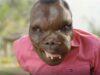 I’m the ‘world’s ugliest man’ — my rare disease turns my muscles and tissues into bone
