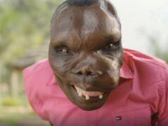 I’m the ‘world’s ugliest man’ — my rare disease turns my muscles and tissues into bone