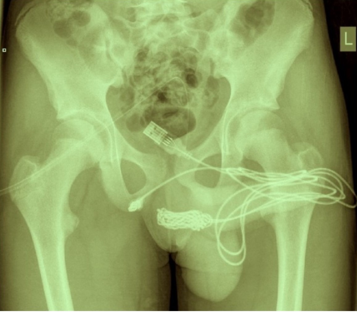 The most embarrassing medical procedure
