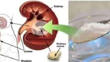 Repair Kidney Damage Quickly with Just One Teaspoon of Common Household Ingredient